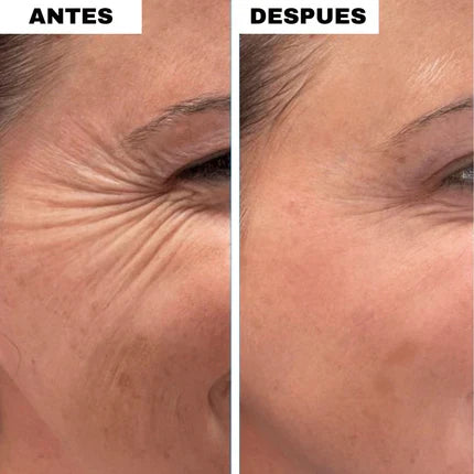 Bálsamo de Colágeno Antiarrugas™